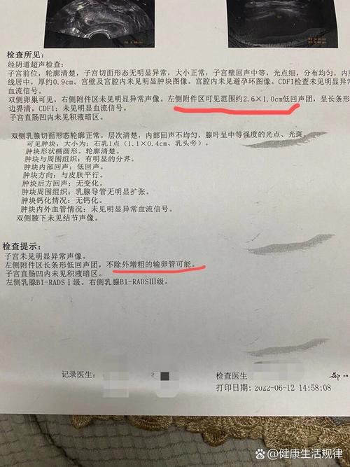 输卵管增粗