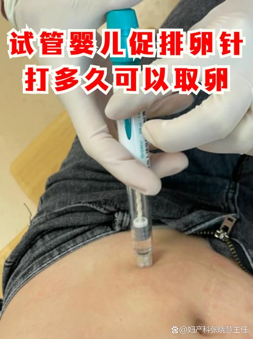 排卵针注射