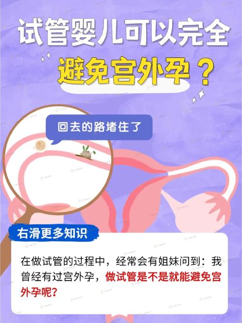 试管婴儿是否容易出现宫外孕？