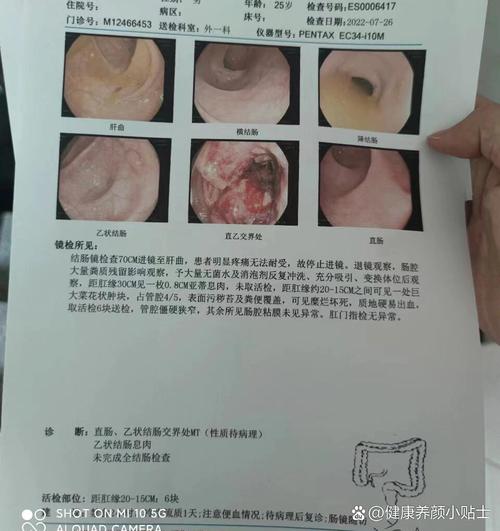 抗癌