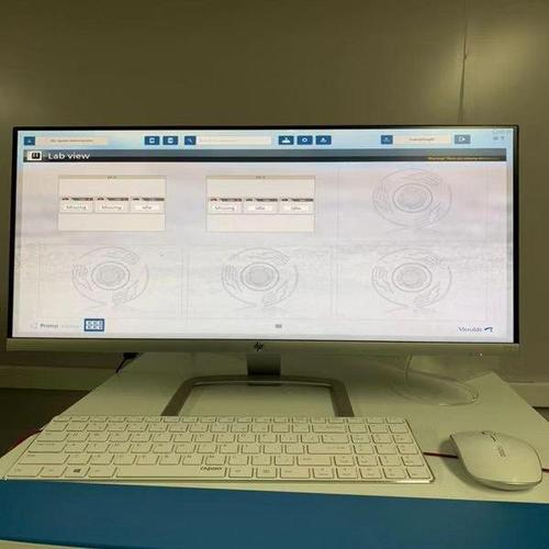 胚胎监测系统