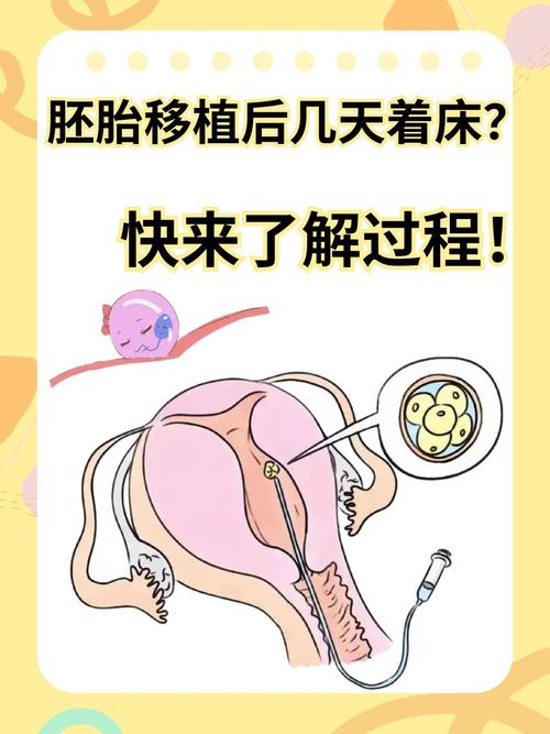 胚胎移植压力