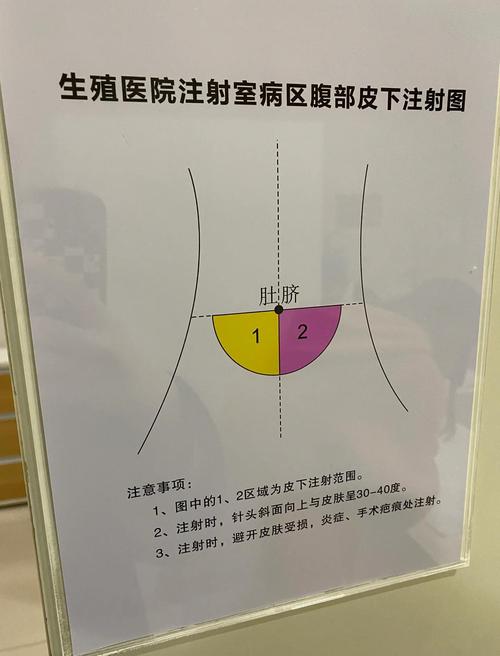 重新促排