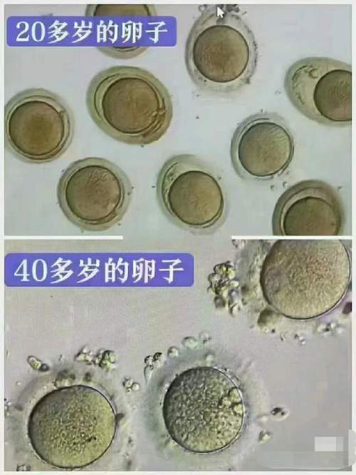 剩余卵子