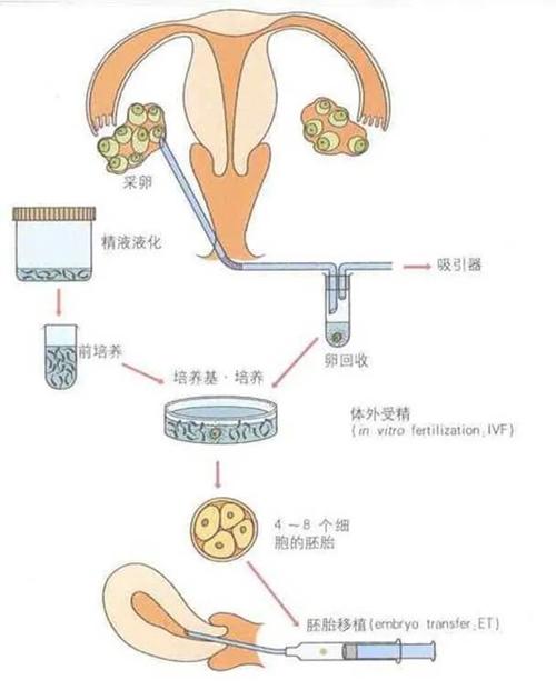 卵子在试管婴儿中的流程复杂吗？
