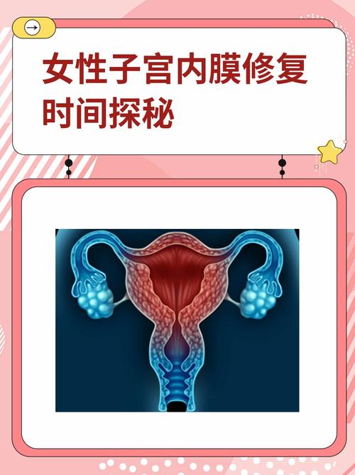 内膜修复