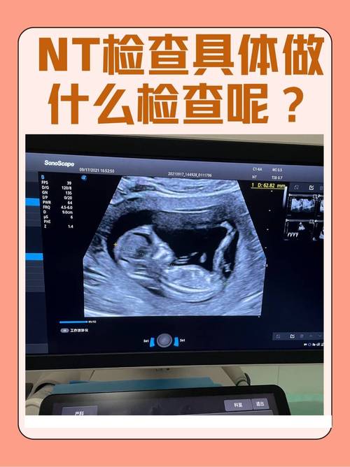胎儿检查