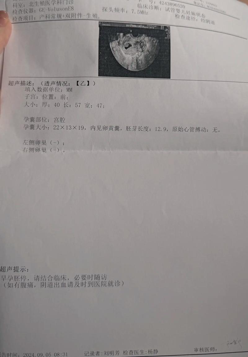 胎停诊断