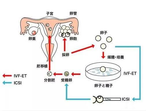 试管婴儿进展