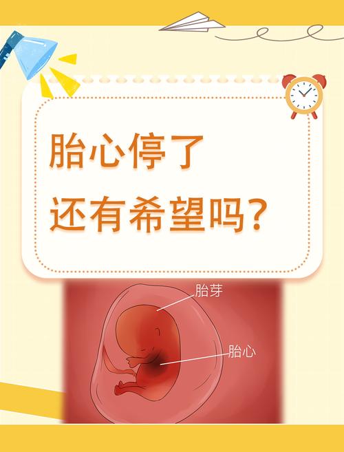  停胎心