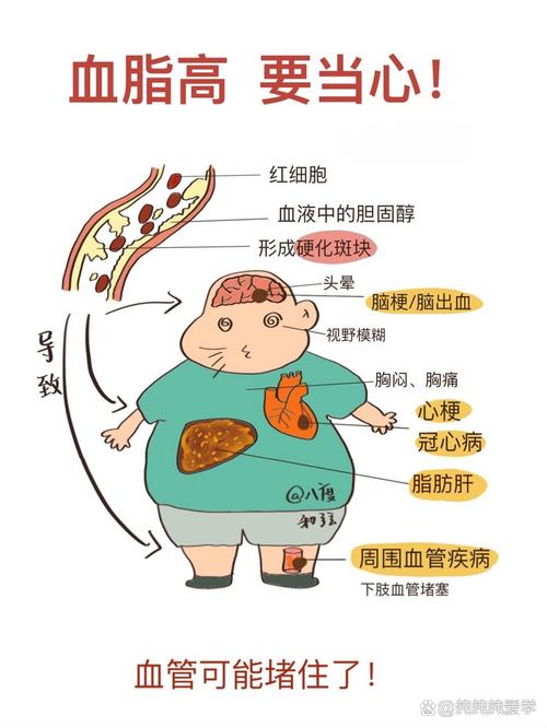 高胆固醇血症