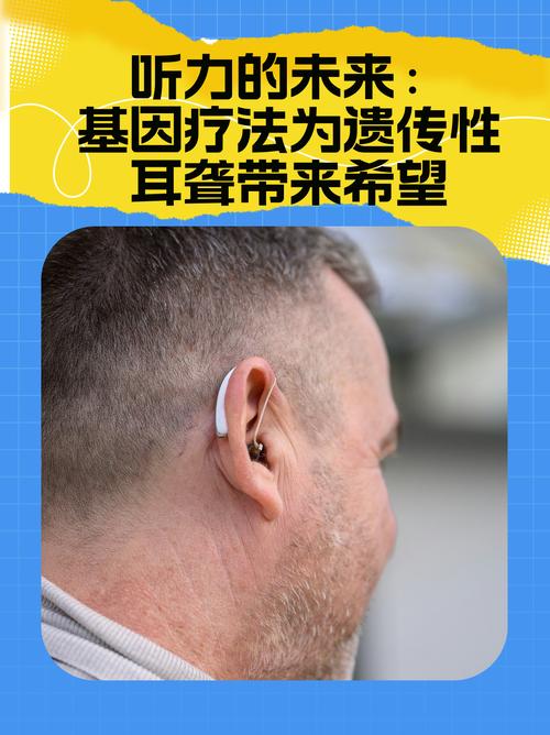 遗传性耳聋