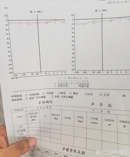  听力恢复