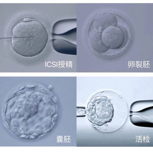 东北三代试管婴儿