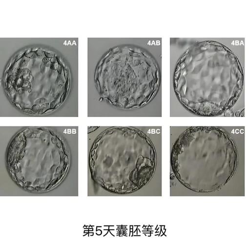 胚胎记录技术