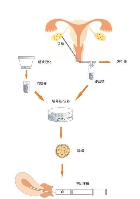 在哪些情况下需要考虑试管婴儿这一生育方式？
