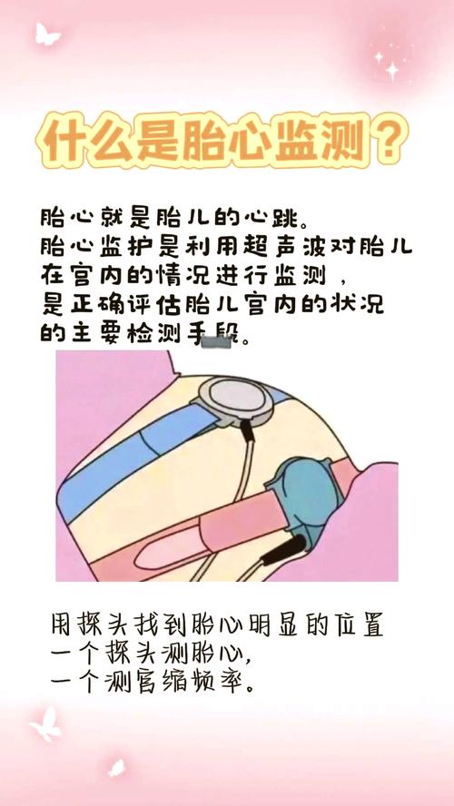 胎心检查