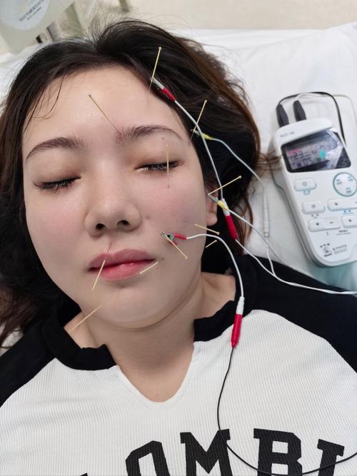 打脸针