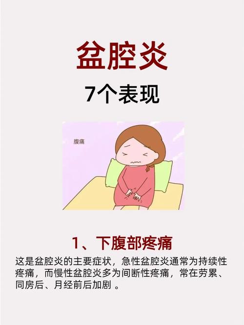 盆腔炎