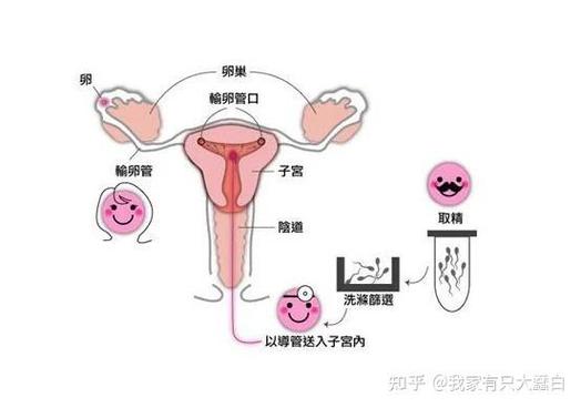 <生殖辅助技术>