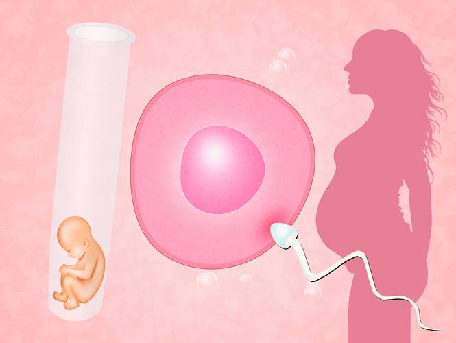 试管婴儿痛经会遗传给下一代吗？