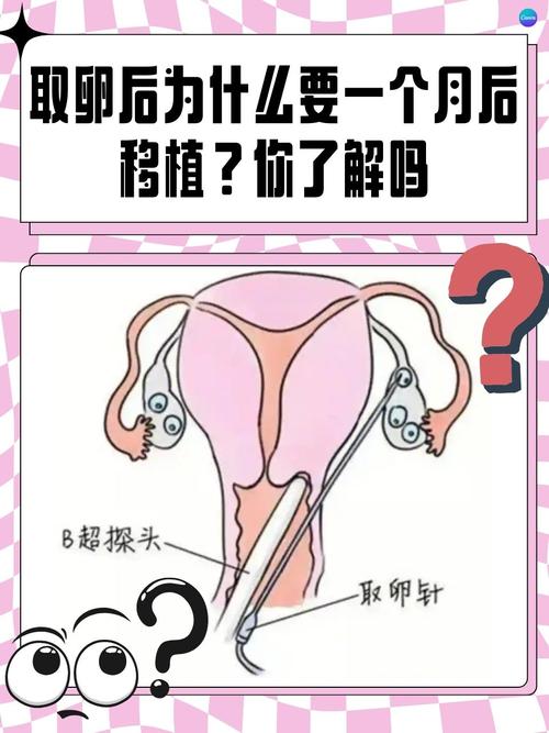 试管婴儿移植手术为何如此挑战？