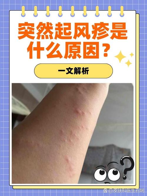 风疹