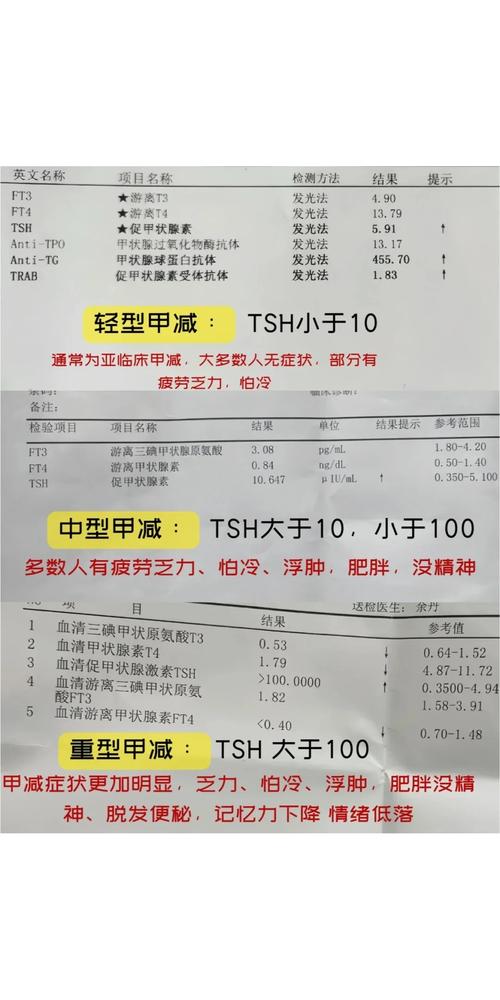 移植前甲减
