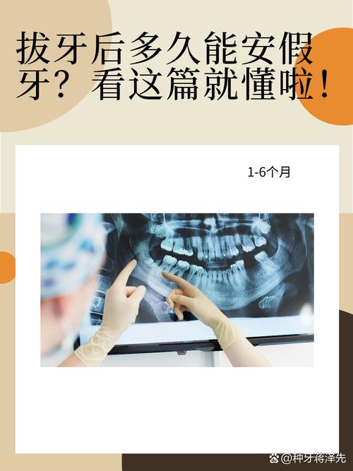 拔牙后多久能进行试管婴儿？