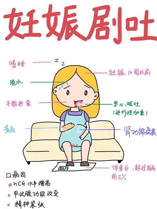 妊娠剧吐