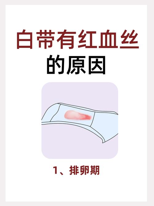 白带红丝
