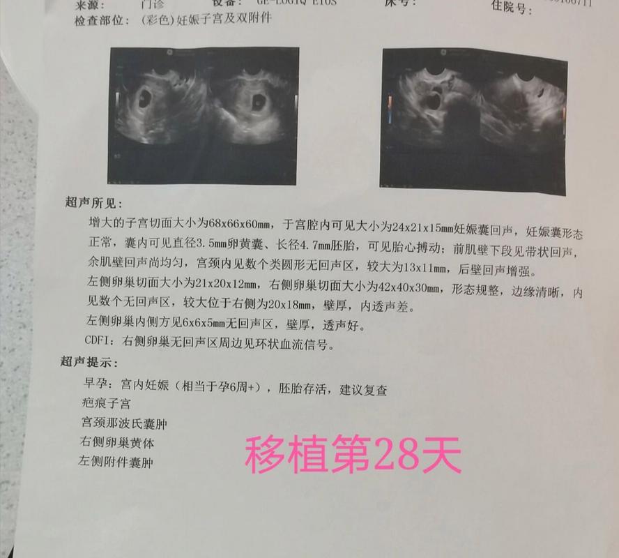 试管婴儿第几天会出现胎心？