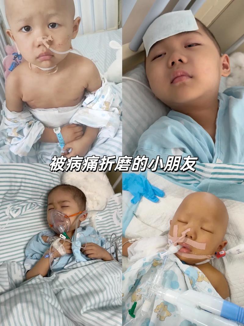 儿童癌症