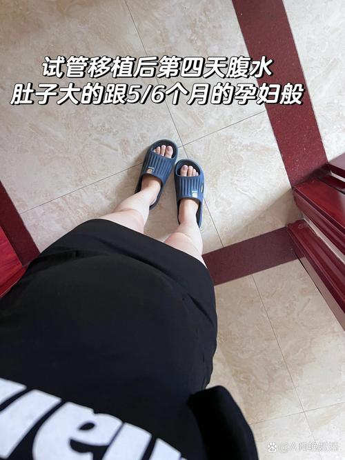 试管婴儿腹水多是正常现象吗？