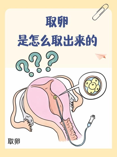  自然取卵