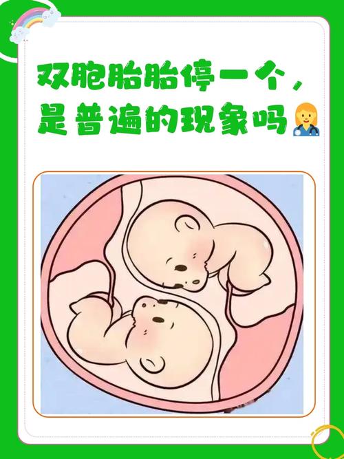 双胎生育
