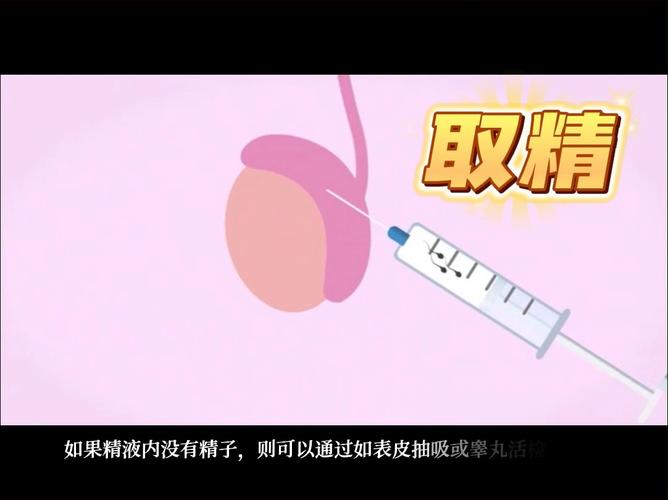 自然射精取精