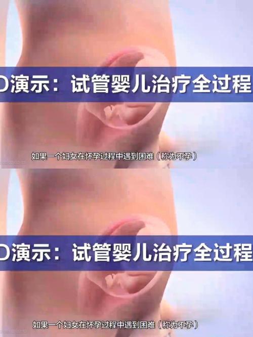 防癌试管婴儿