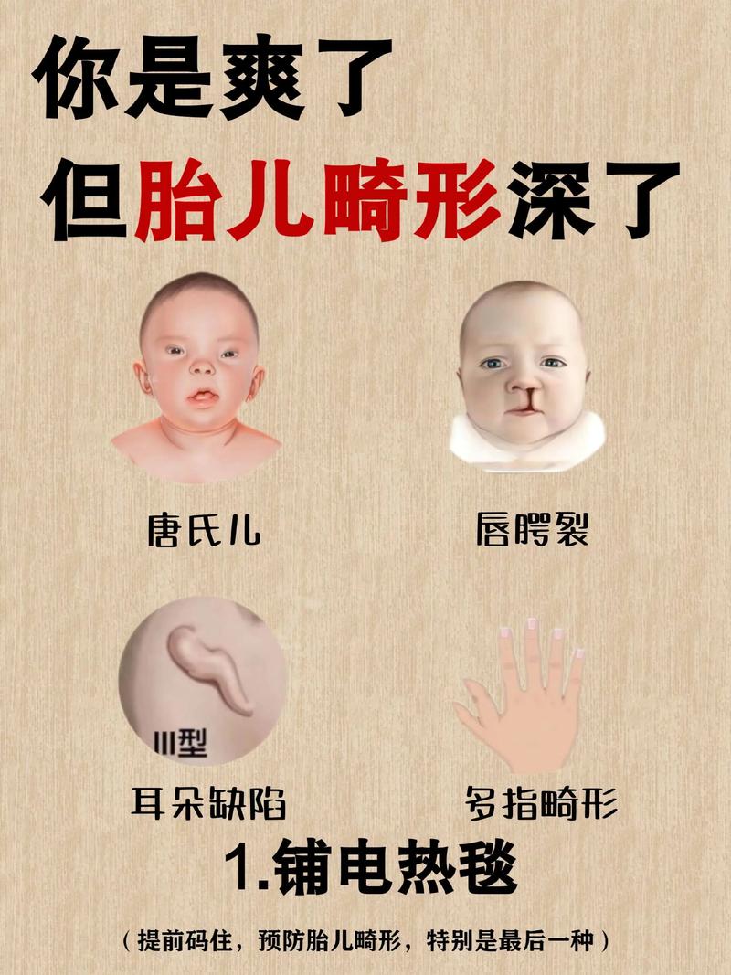 畸形胎儿