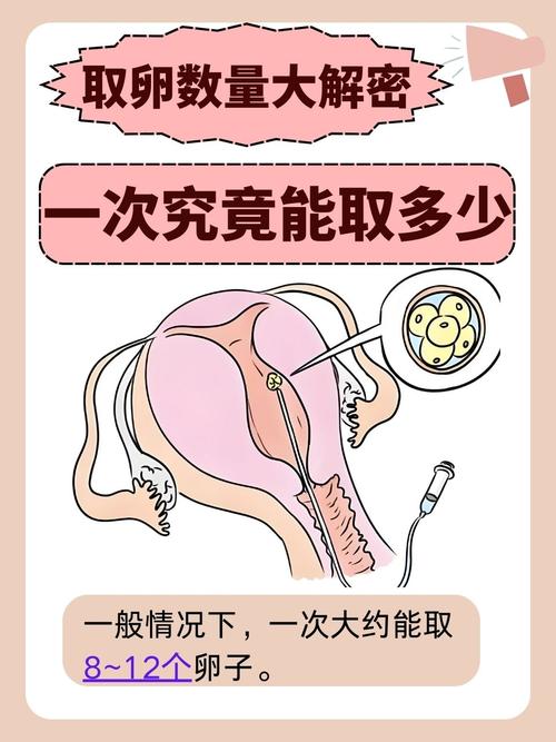 采卵数量