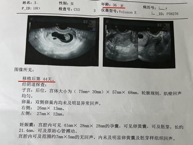 试管婴儿移植后多久能做B超检查？