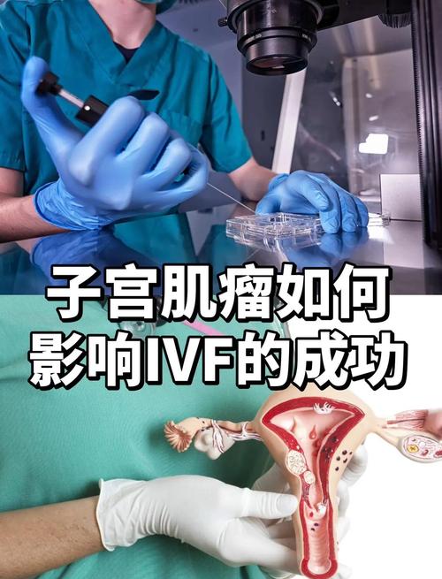 子宫肌瘤会影响试管婴儿成功率吗？