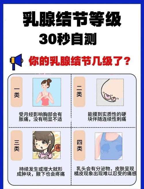 乳腺结节4级