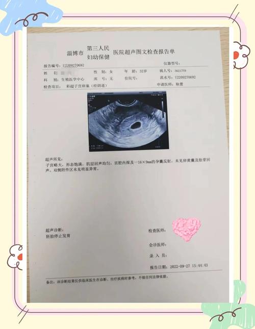 囊胚发育停滞