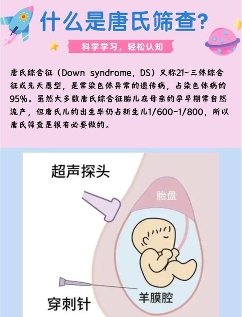 唐氏儿筛查