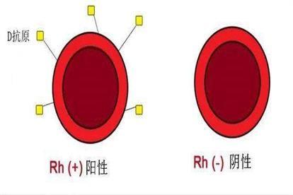 Rh血型