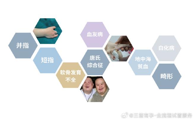 试管婴儿技术能否预防唐氏综合症？