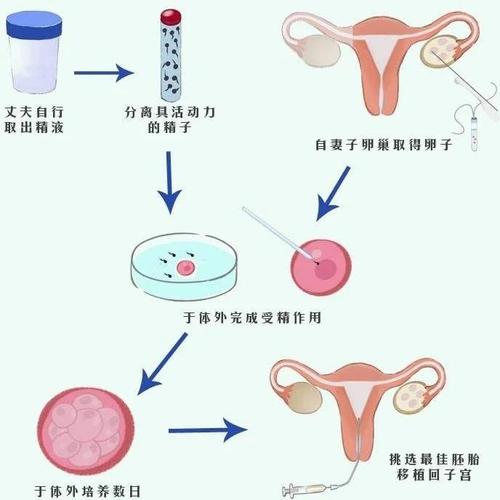 试管婴儿：人伦产物还是科技奇迹？