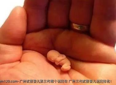 适龄试管婴儿