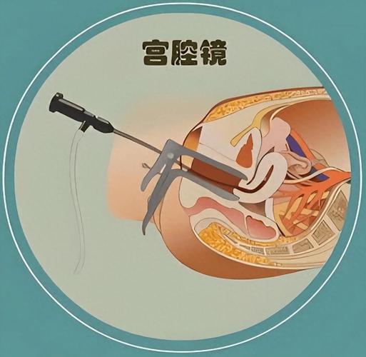 女性妇科助孕